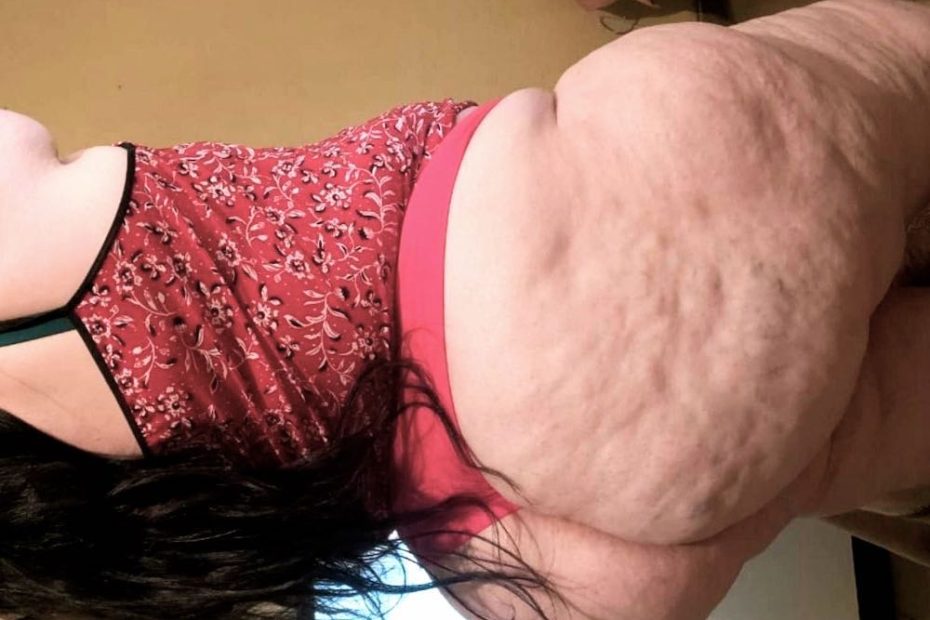 Willst du deinen Cellulite Fetisch ausleben