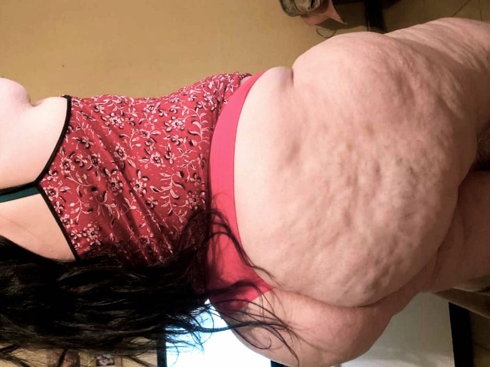 Willst du deinen Cellulite Fetisch ausleben